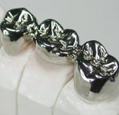 Próteses dentárias