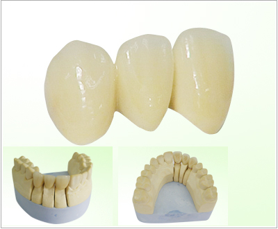 Aparelhos dentários de correcção