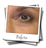 Saude melhor = Adesivos Lifewave Y AGE GLUTATIONA